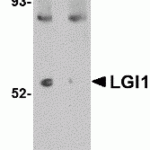 Western blot analysis of LGI1 in mouse brain tissue lysate with LGI1 antibody at 1 μg/mL in (A) the absence and (B) the presence of blocking peptide.