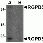 Western blot analysis of RGPD5 in human thymus tissue lysate with RGPD5 antibody at 1 μg/mL in (A) the absence and (B) the presense of blocking peptide.