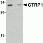Western blot analysis of GRTP1 in SK-N-SH cell lysate with GRTP1 antibody at 1 μg/mL in the (A) absence and (B) presence of blocking peptide.