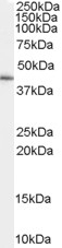 SLC22A16 Antibody