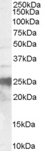 SLIT2 Antibody