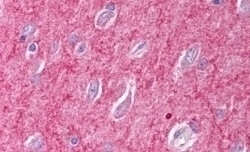 SNX26 Antibody