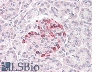 SOCS4 Antibody
