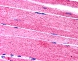 SORBS1 Antibody