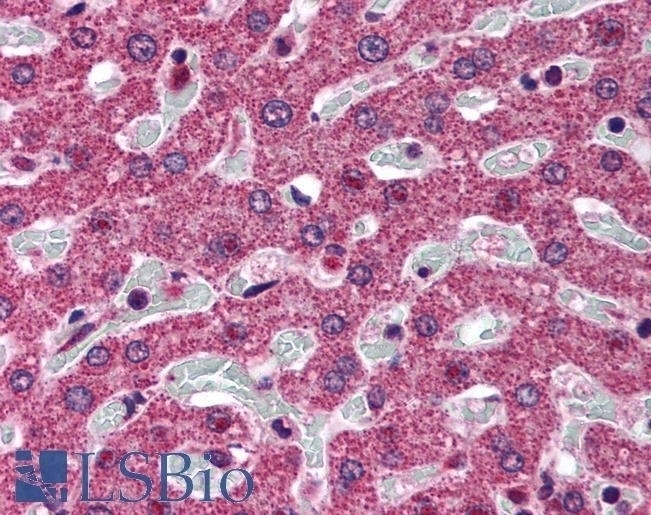 SRD5A1 Antibody