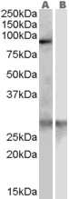 SREC Peptide