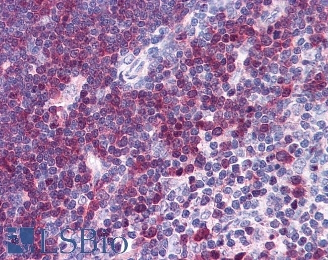 Stathmin 1 Antibody
