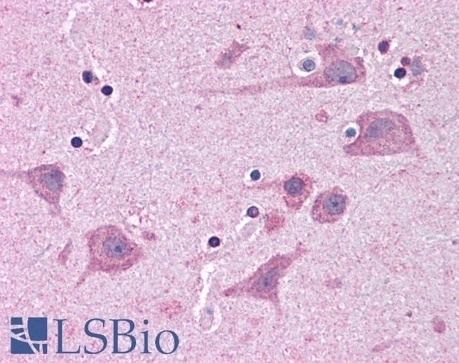 TAB182 Antibody