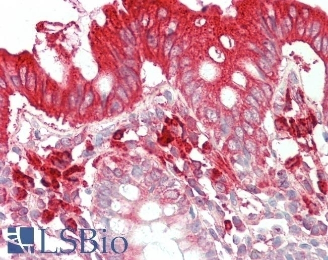 TFB2M Antibody