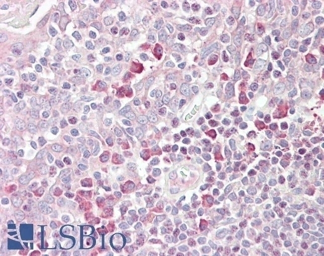 Thrb Antibody