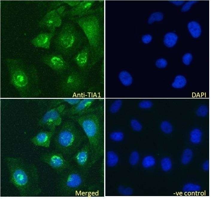 TIA1 Antibody