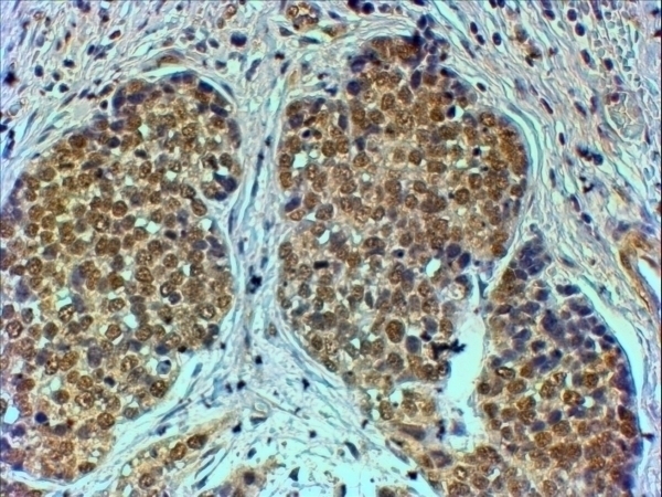 TIF1 alpha Antibody