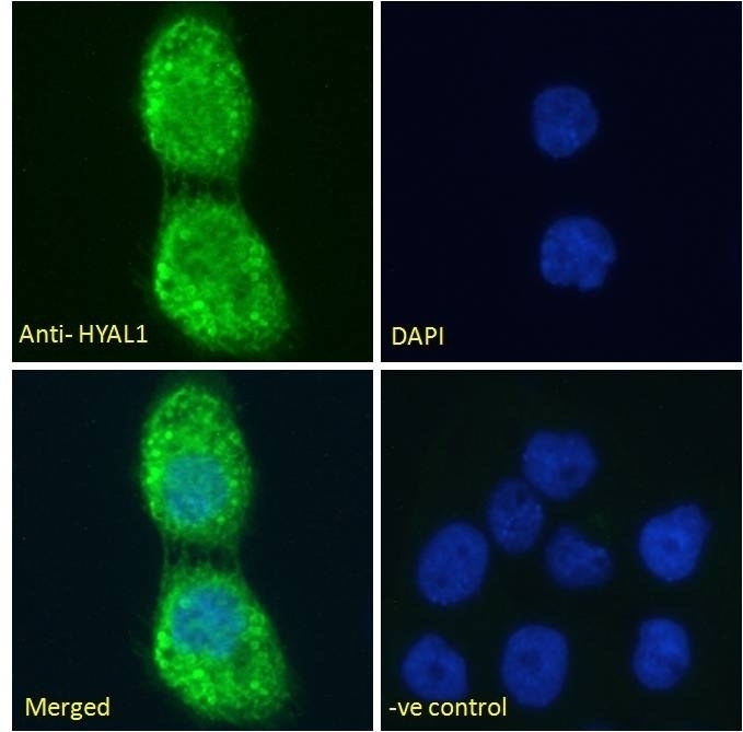 TPD52 Antibody