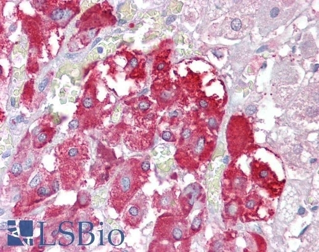 TPTE Antibody
