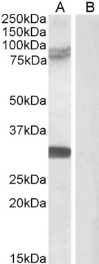TRIM2 Antibody