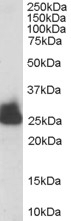 Triosephosphate isomerase Antibody