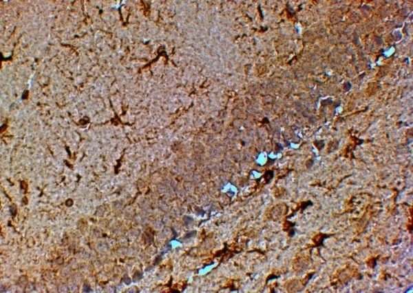 TRPM7 Antibody