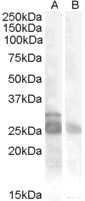 TRPV5 Antibody