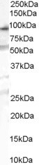 Tryptophan hydroxylase-2 Antibody
