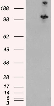 TSC1 Antibody