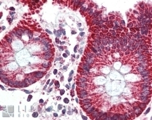 TSPO Antibody