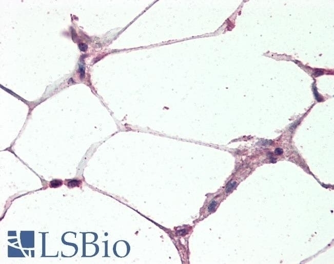 UCP2 Antibody