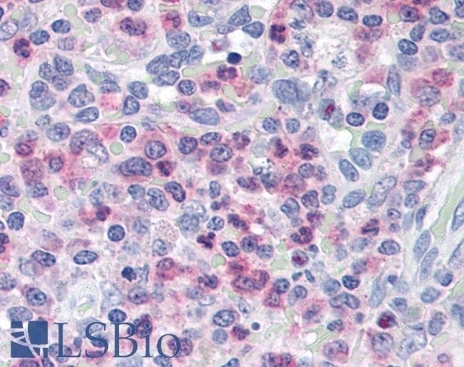 UNC13D Antibody