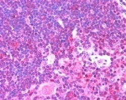 UNC13D Antibody