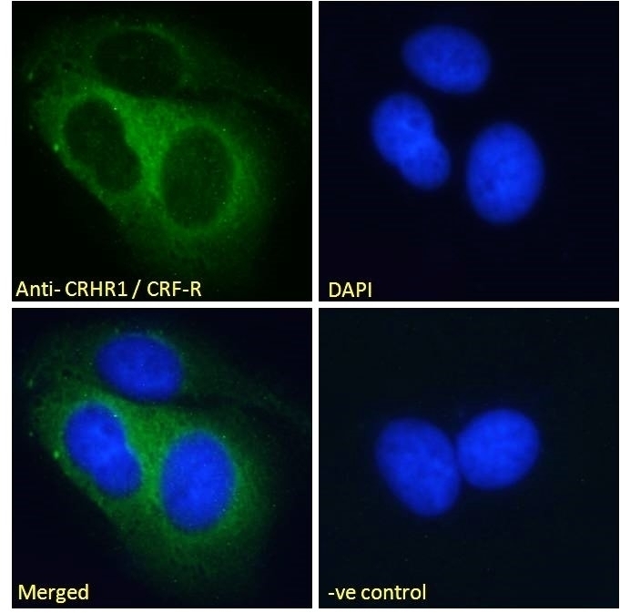 VHNF1 Antibody