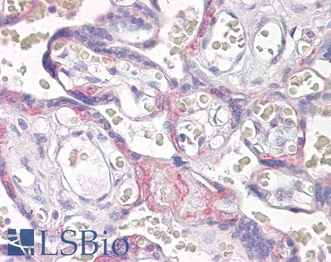 VPS41 Antibody