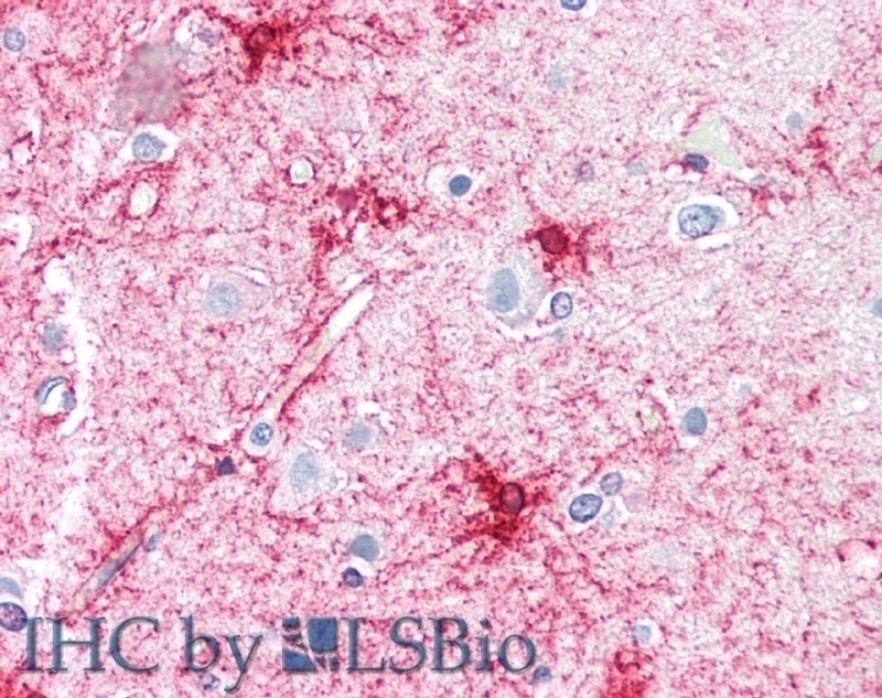VPS45 Antibody