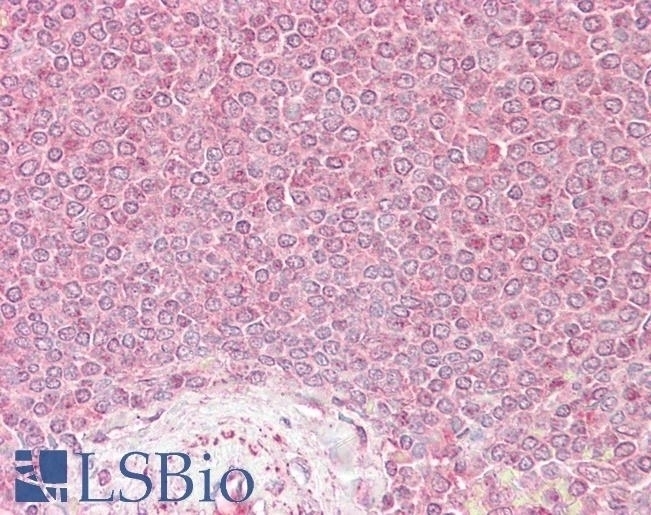 VPS45 Antibody