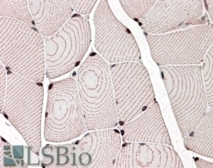 ZASP Antibody
