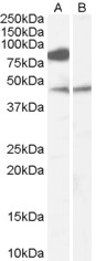 ZDHHC8 Peptide