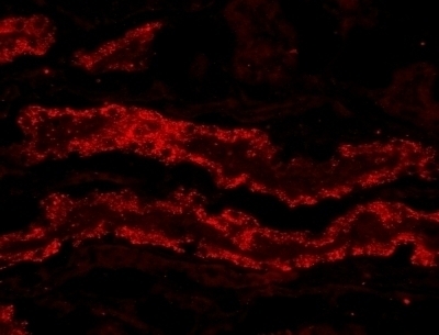 ZDHHC8 Antibody