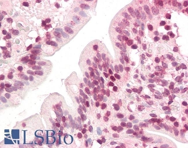 ZIC5 Antibody
