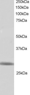 ZNF230 Antibody
