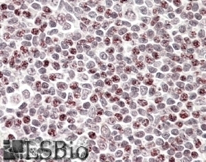 ACTL7B Antibody