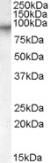 ADRB3 Antibody