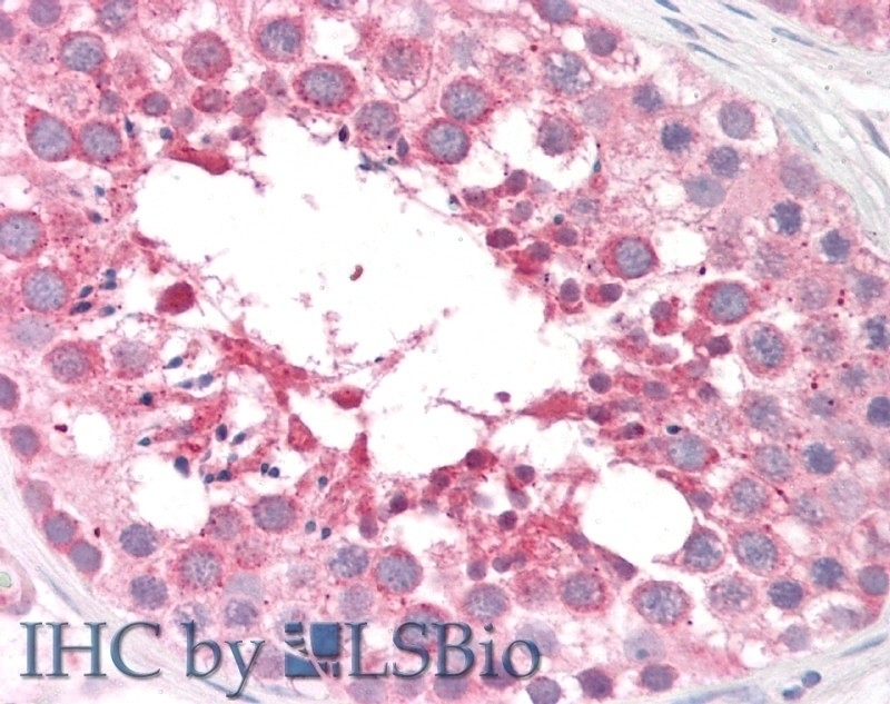 Arylsulfatase A Antibody