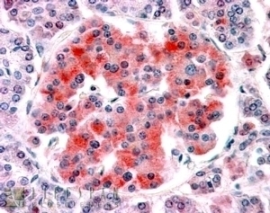 ASRGL1 Antibody