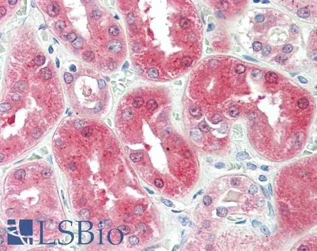 BDH2 Antibody