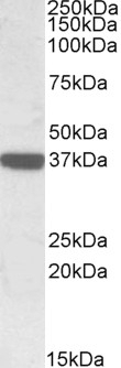 SPHK1 Antibody