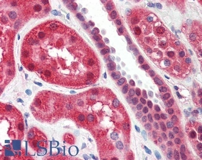 ALOX15 Antibody
