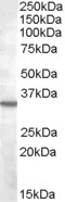 Apolipoprotein B Antibody