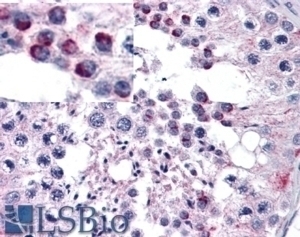ATG16L1 Antibody