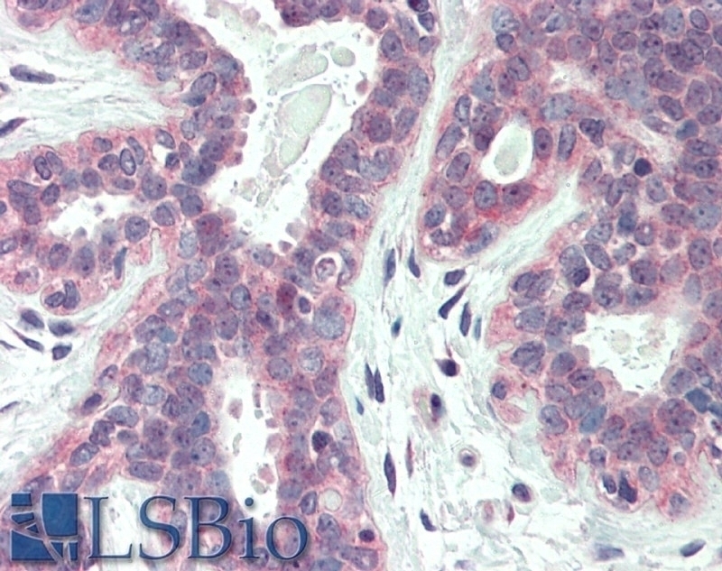 Sterol Carrier Protein 2 Antibody