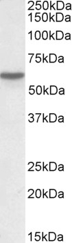 Tribbles Homolog 1 Antibody