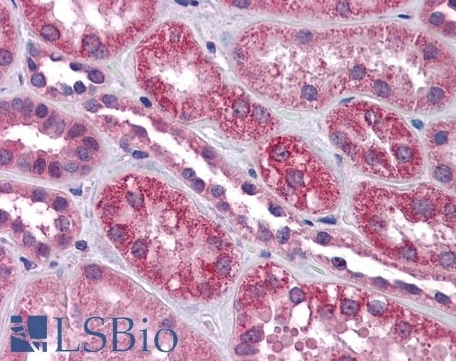 TRPC4 Antibody