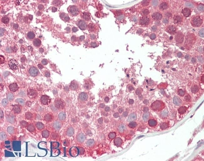 EBF1 Antibody